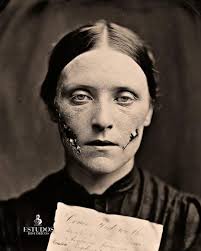 A história de Ada Morrison - Portal iMulher